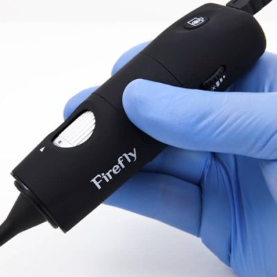 Digital Video Otoscope